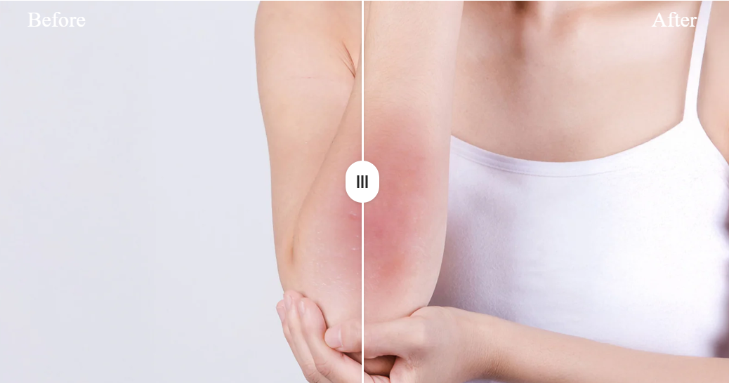 Led Red Light Therapy Panel